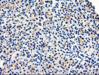 DPP10 Antibody