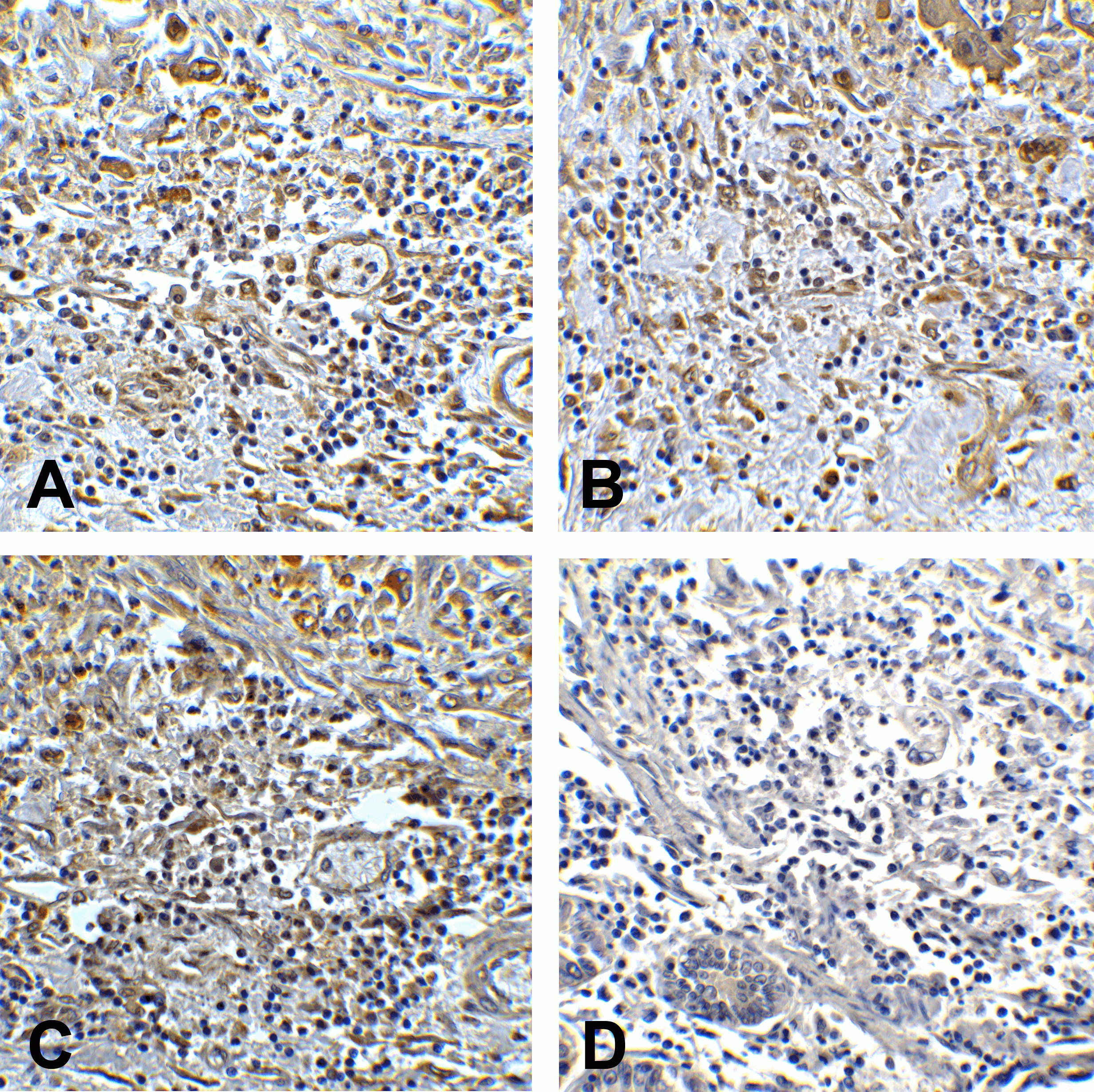 TMIGD2 Detection Set (Risk Free)