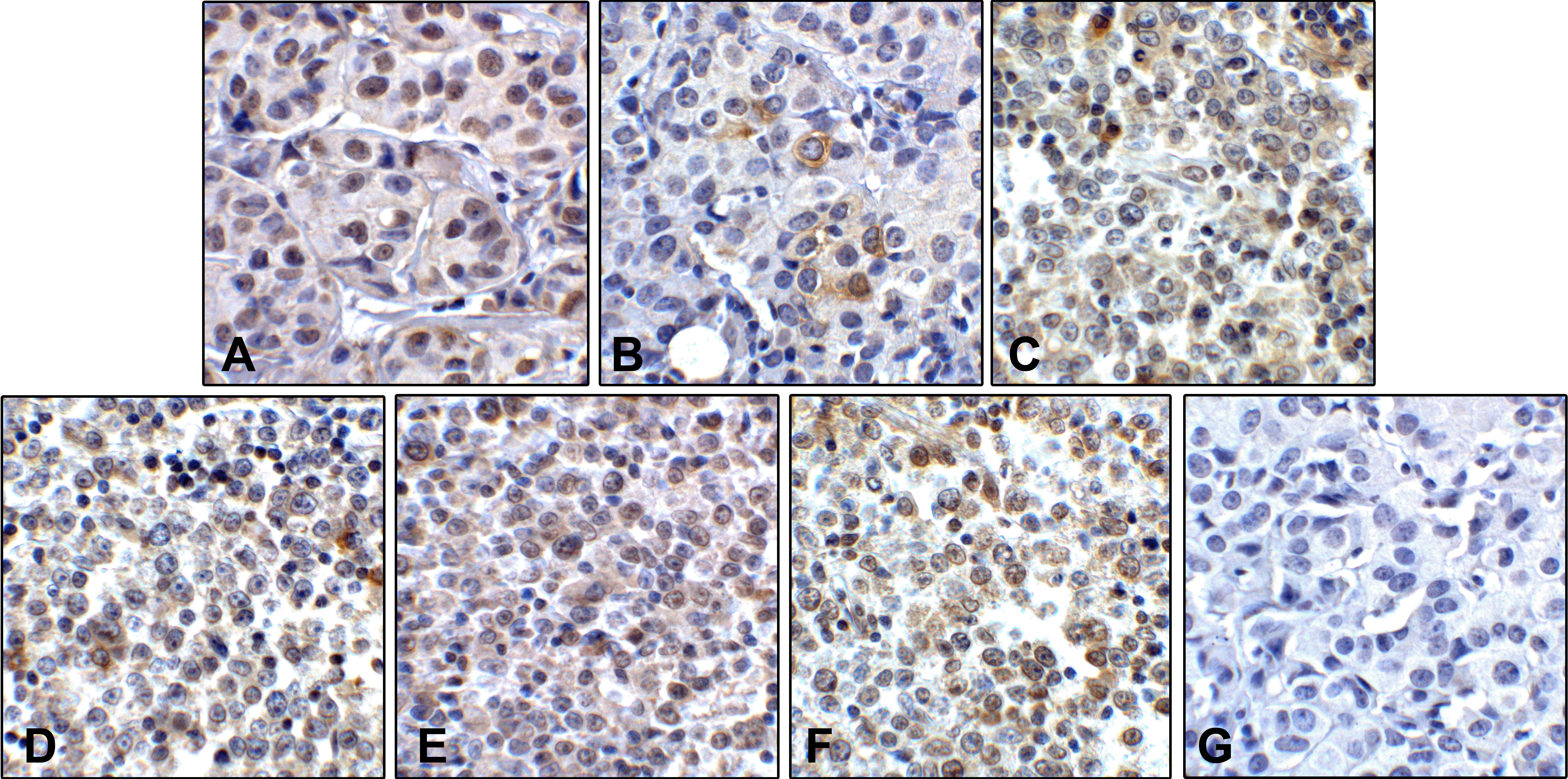 LAG3 Detection Set (Risk Free)