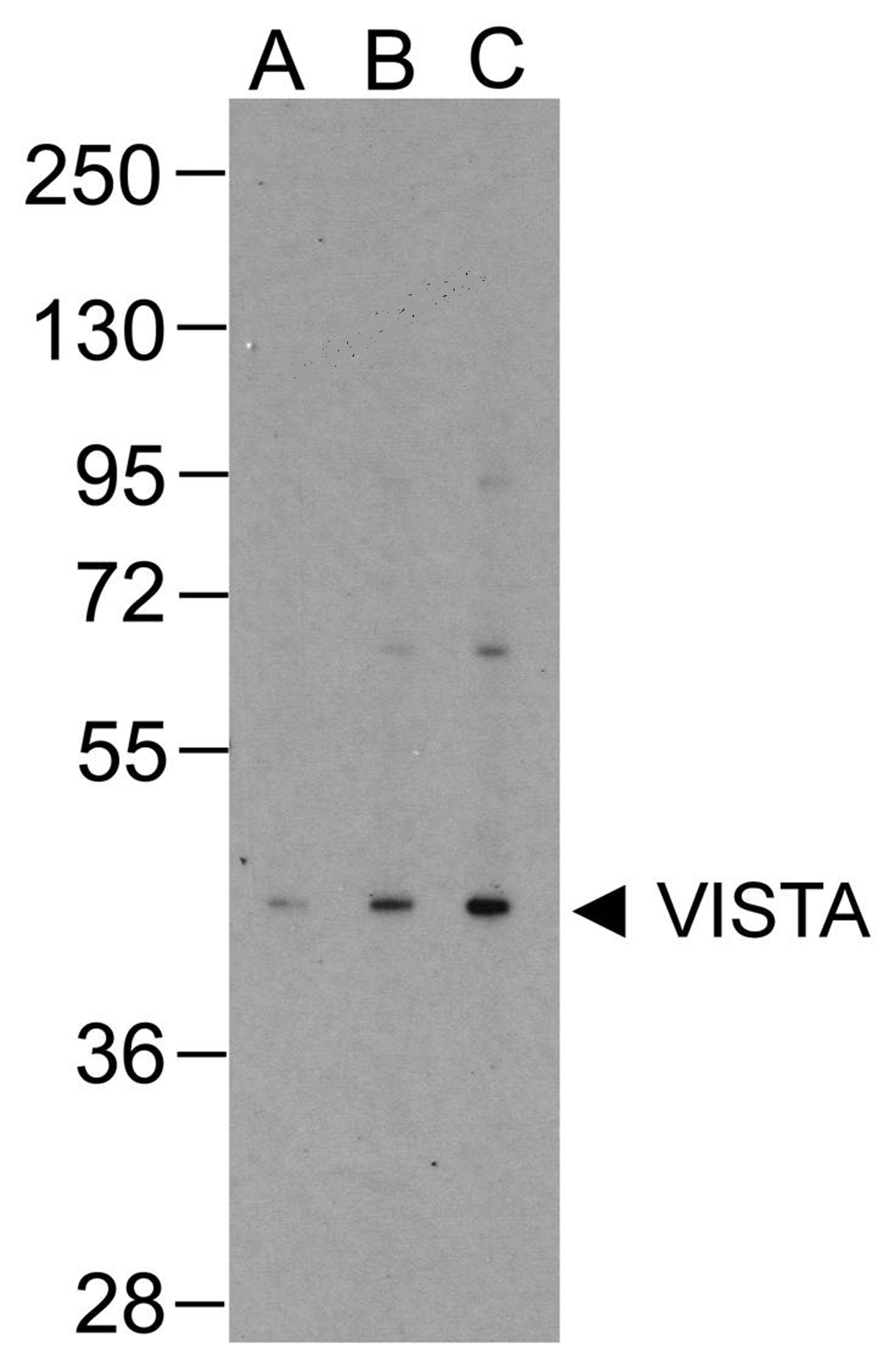 VISTA Detection Set (Risk Free)
