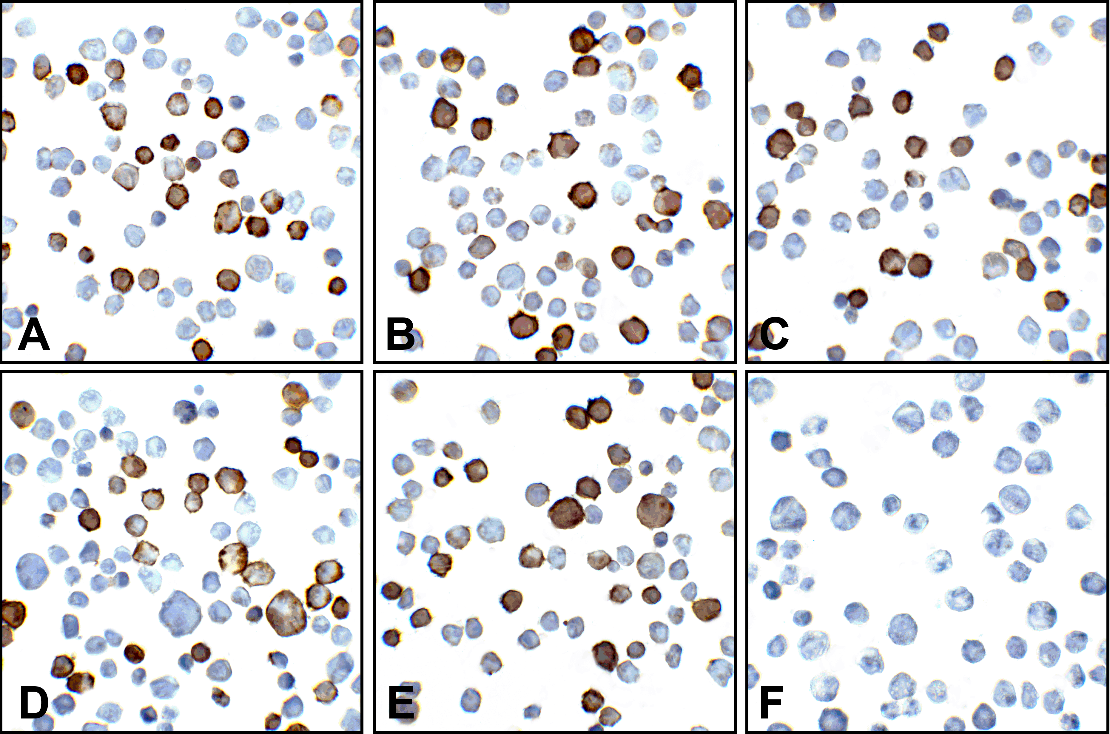 PDL2 Detection Set (Risk Free)