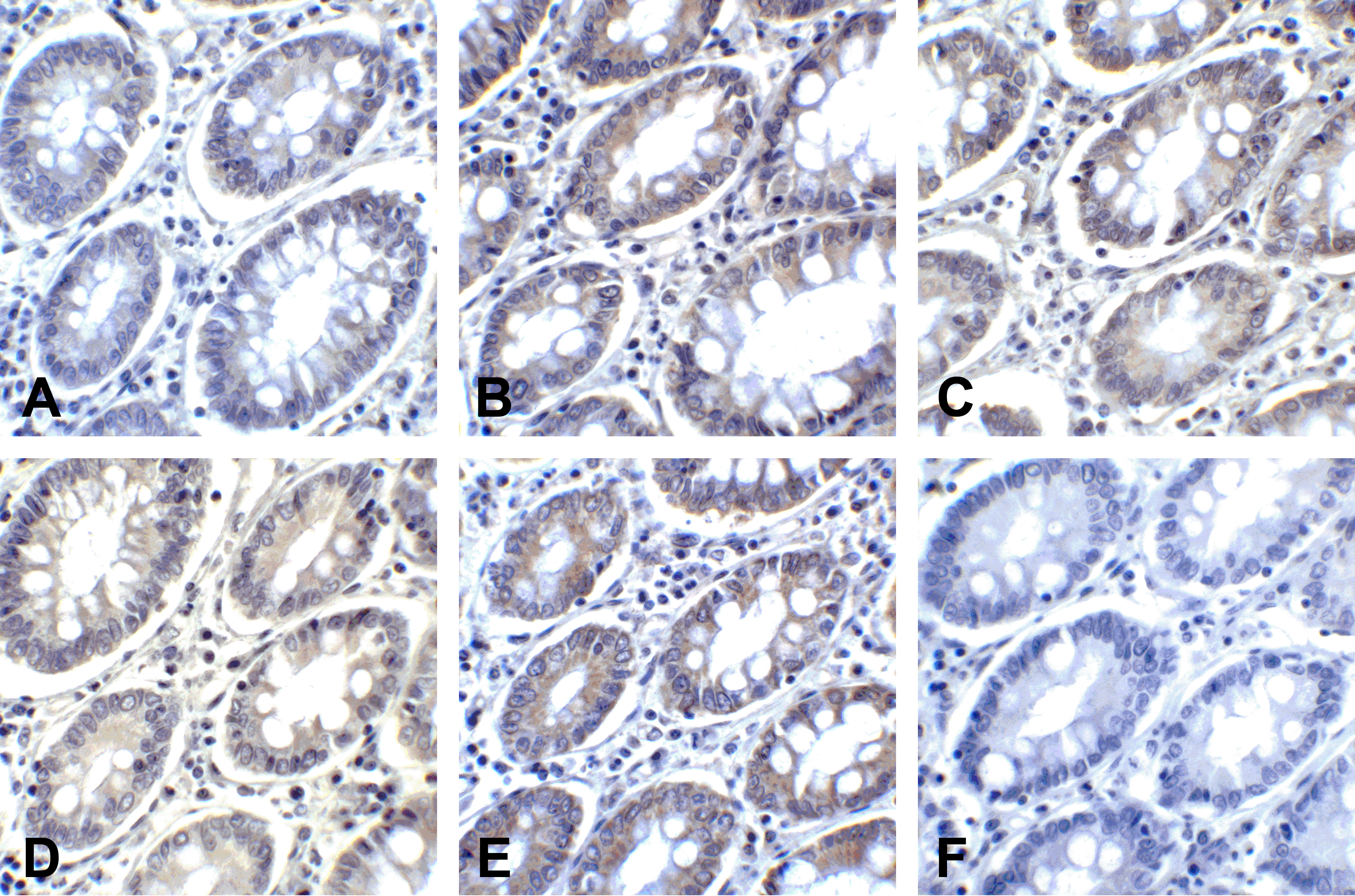 PDL2 Detection Set (Risk Free)