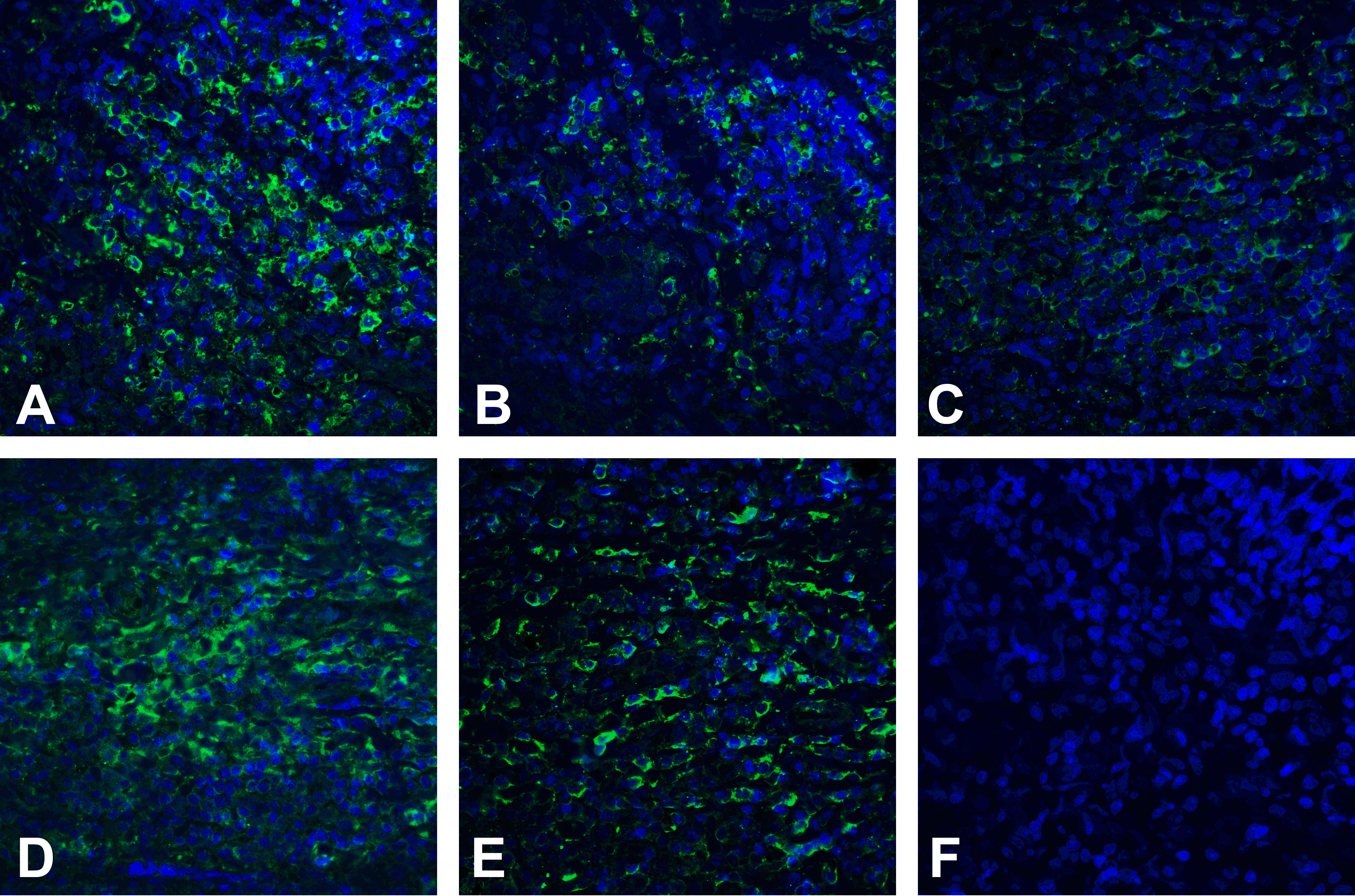 PDL2 Detection Set (Risk Free)