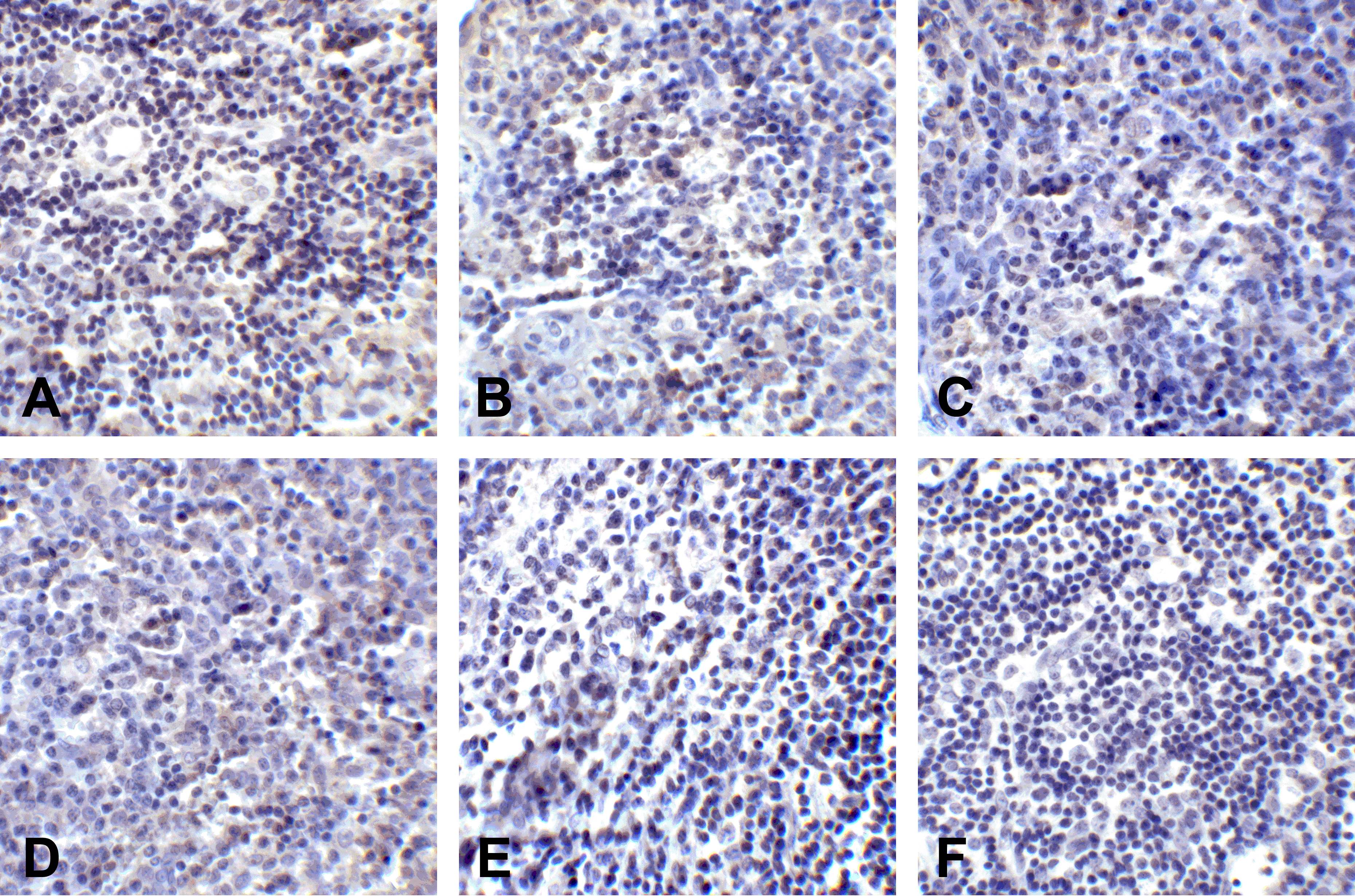 PDL2 Detection Set (Risk Free)
