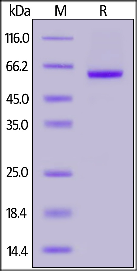SARS-CoV-2 (COVID-19) S RBD Recombinant Protein