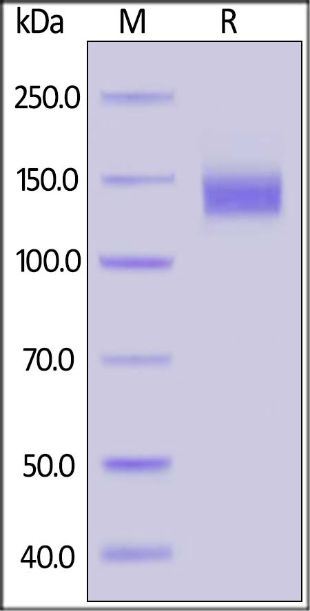 SARS-CoV-2 (COVID-19) S1 Recombinant Protein