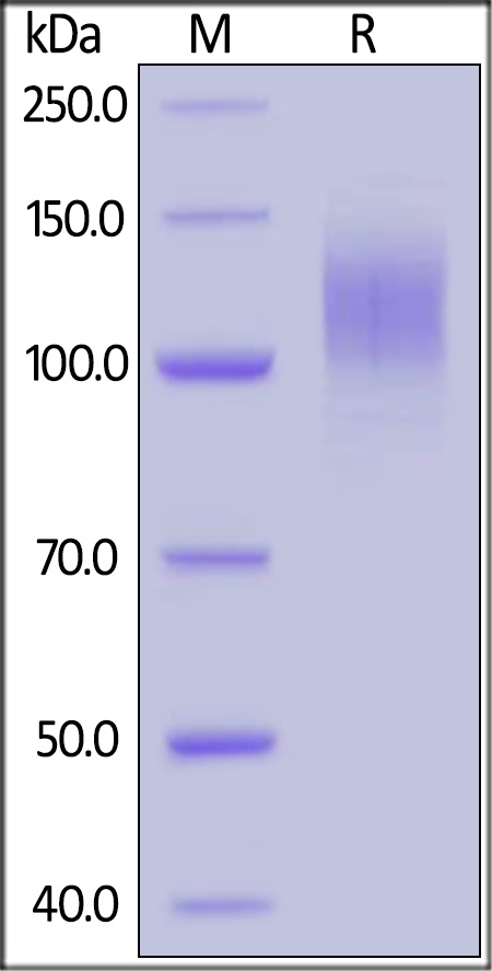 SARS-CoV-2 (COVID-19) S1 Recombinant Protein