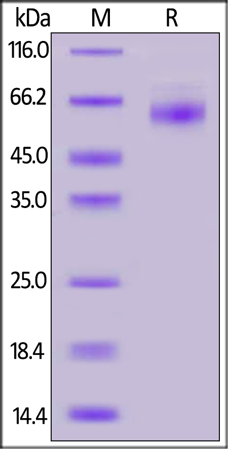 SARS-CoV-2 (COVID-19) Nucleocapsid Recombinant Protein