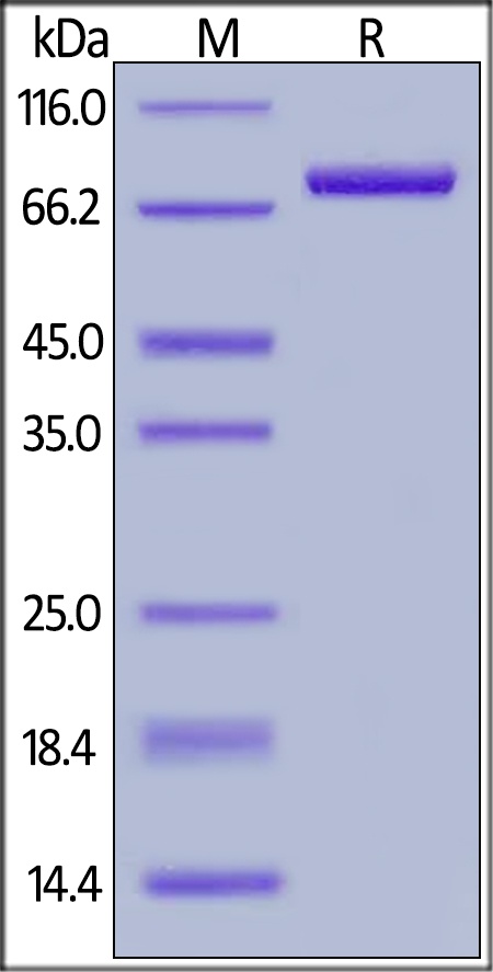 CD4 Recombinant Protein