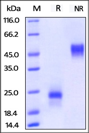 VEGF 165 Recombinant Protein