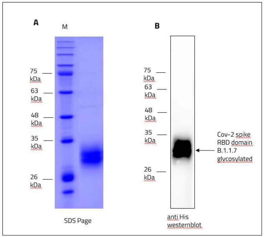 SARS-CoV-2 (COVID-19) Alpha Variant (B.1.1.7, UK) Spike RBD Recombinant Protein