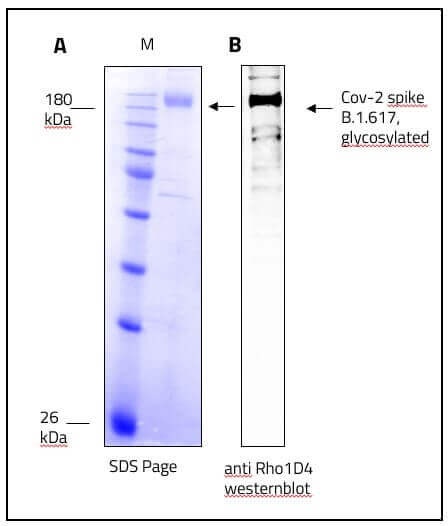 SARS-CoV-2 (COVID-19) Full-Length Kappa Variant (B.1.617.1, India) Spike Recombinant Protein