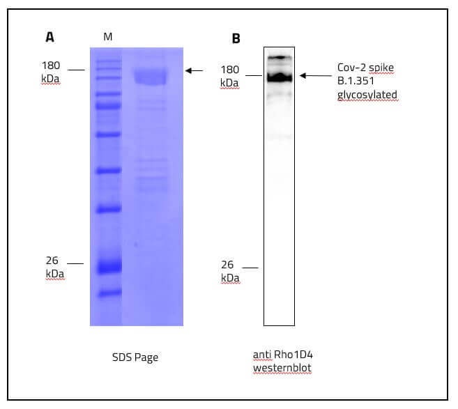 SARS-CoV-2 (COVID-19) Full-Length Beta Variant (B.1.351, SA) Spike Recombinant Protein