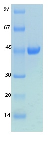 SARS-CoV-2 (COVID-19) NSP8 Recombinant Protein