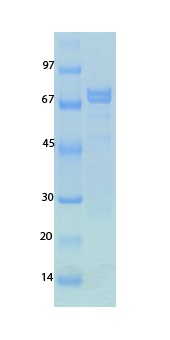 SARS-CoV-2 (COVID-19) Nucleocapsid Recombinant Protein