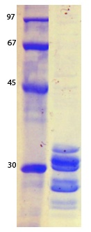 SARS Coronavirus Envelope (HSZ-Cc) Recombinant Protein