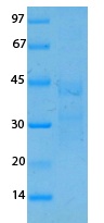 SARS Coronavirus Membrane (HSZ-Cc) Recombinant Protein