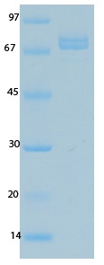 SARS Coronavirus Nucleocapsid (HSZ-Cc) Recombinant Protein