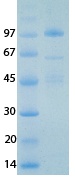 SARS-CoV-2 (COVID-19) NSP14 Recombinant Protein