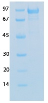 SARS-CoV-2 (COVID-19) Nucleocapsid Recombinant Protein