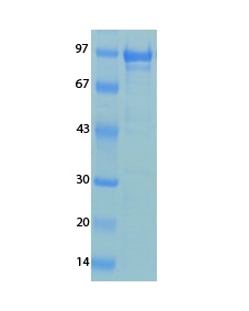 Human Coronavirus OC43 Recombinant Protein
