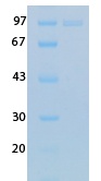 SARS Coronavirus Nucleocapsid (HSZ-Cc) Recombinant Protein