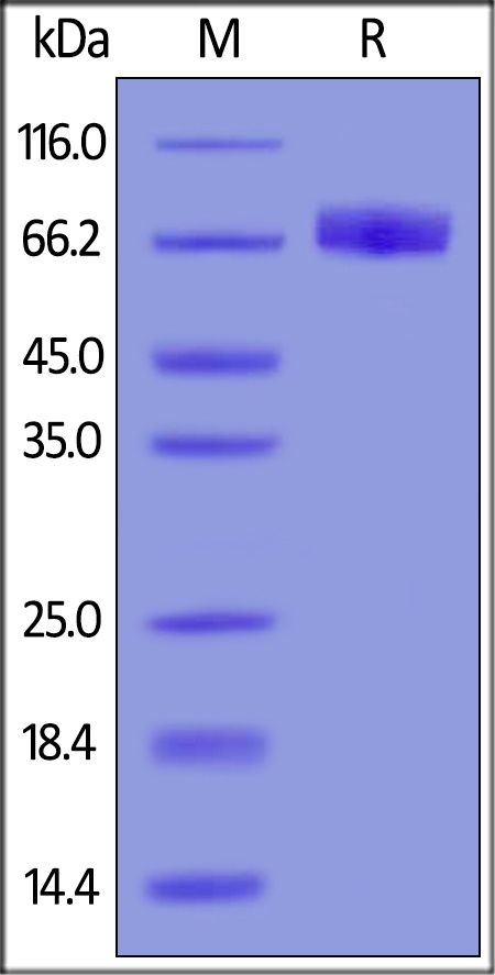 IL-4 R alpha / CD124 Recombinant Protein
