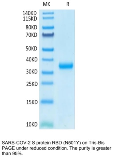 SARS-CoV-2 (COVID-19) UK variant (B.1.1.7) S RBD (N501Y) Recombinant Protein