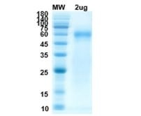 SARS-CoV-2 (COVID-19) Nucleocapsid Recombinant Protein