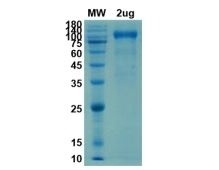 Human ACE2 Recombinant Protein