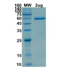 SARS-CoV-2 (COVID-19) S2 Recombinant Protein