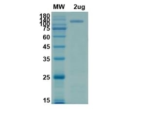 SARS-CoV-2 (COVID-19) S1 Recombinant Protein