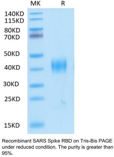 SARS Spike RBD Recombinant Protein
