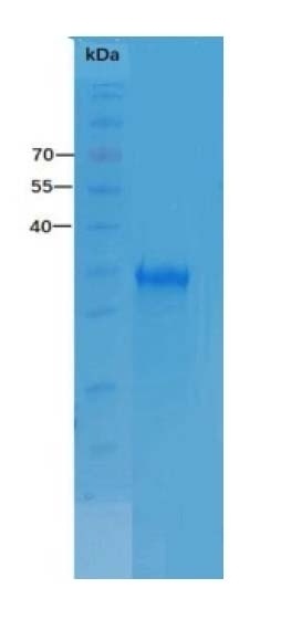 SARS-CoV-2 (COVID-19) Spike-RBD Recombinant Protein