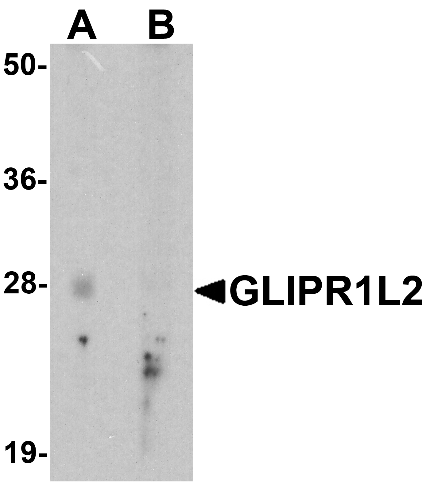 GLIPR1L2 Peptide