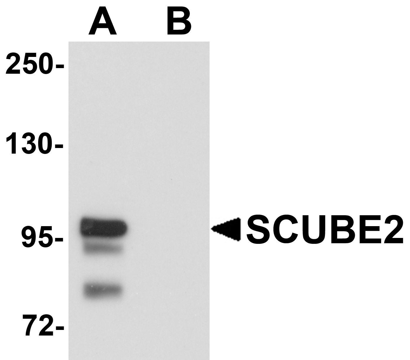 SCUBE2 Peptide