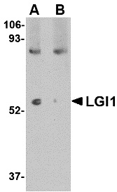 LGI1 Peptide