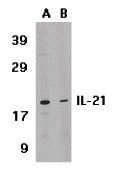 IL-21 Peptide