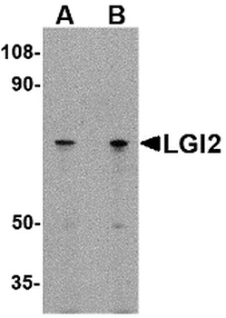 Lgi2 Antibody