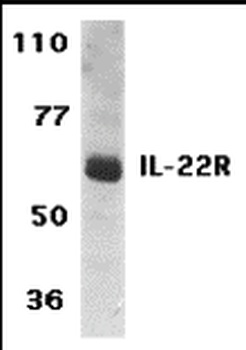 IL22RA1 Antibody