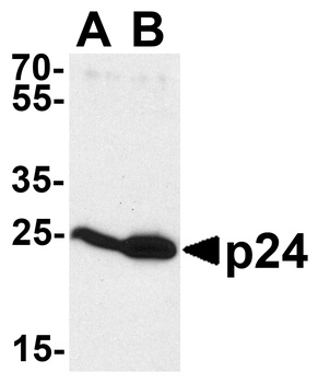 GAG Antibody