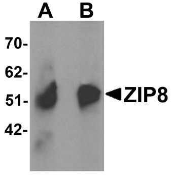 Slc39a8 Antibody
