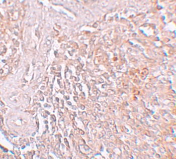 Slc39a8 Antibody