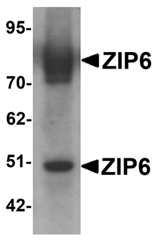 SLC39A6 Antibody