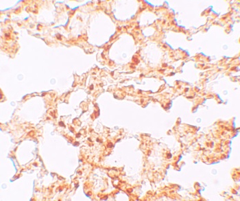 SLC39A6 Antibody