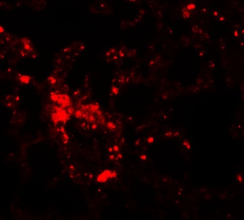 SLC39A6 Antibody