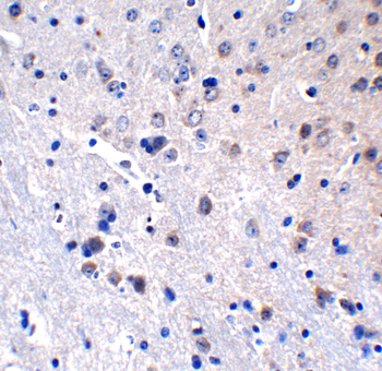ZBP1 Antibody