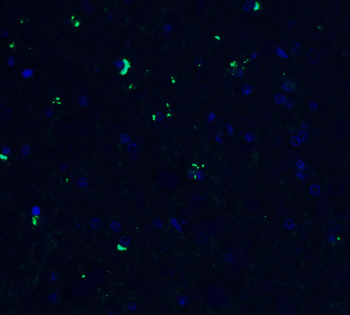 ZBP1 Antibody