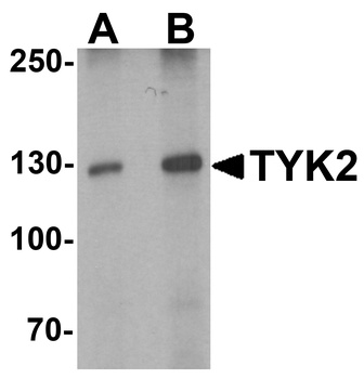 TYK2 Antibody