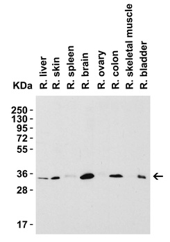 SIGLEC15 Antibody